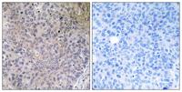 NDUFS7 Polyclonal Antibody