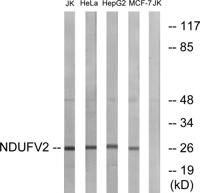 NDUFV2 Polyclonal Antibody