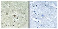 NDUFV3 Polyclonal Antibody