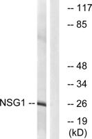 NEEP21 Polyclonal Antibody