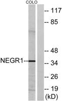 NEGR1 Polyclonal Antibody