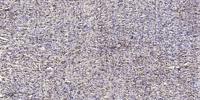 Nek4 Polyclonal Antibody