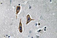Nephrin Polyclonal Antibody