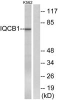 Nephrocystin-5 Polyclonal Antibody