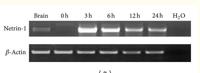 Netrin-1 Polyclonal Antibody