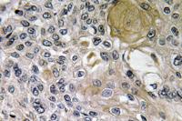 Netrin-1 Polyclonal Antibody