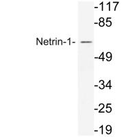 Netrin-1 Polyclonal Antibody