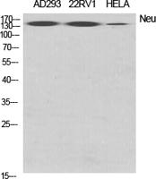 HER2 Polyclonal Antibody