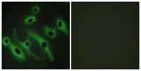 HER2 Polyclonal Antibody