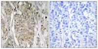 HER2 Polyclonal Antibody