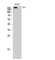 HER2 Polyclonal Antibody