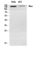 HER2 Polyclonal Antibody