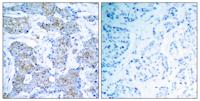HER2 Polyclonal Antibody
