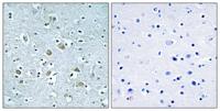 Neuralized-1 Polyclonal Antibody