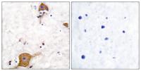 Neuregulin-1 SMDF Polyclonal Antibody