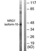 Neuregulin-1 SMDF Polyclonal Antibody