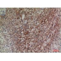 Neuregulin-2 Polyclonal Antibody