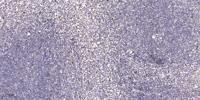 Neuro D2 Polyclonal Antibody