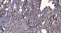 Neurocalcin δ Polyclonal Antibody