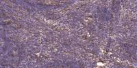 Neurocan Polyclonal Antibody