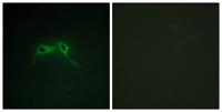 Neurofibromin Polyclonal Antibody