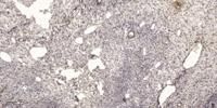 Neurofibromin Polyclonal Antibody