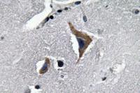 Neurophysin I Polyclonal Antibody