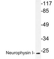 Neurophysin I Polyclonal Antibody