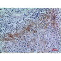 Neuropilin-2 Polyclonal Antibody