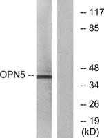 Neuropsin Polyclonal Antibody