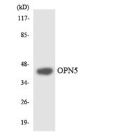 Neuropsin Polyclonal Antibody