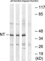 Neurotrimin Polyclonal Antibody