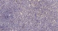 NF-1 Polyclonal Antibody