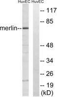 NF2 Polyclonal Antibody