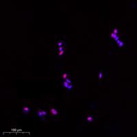 NF90 Polyclonal Antibody