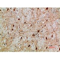 NFAT5 Polyclonal Antibody