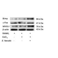 NFATc1 Polyclonal Antibody