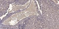 NFATc2IP Polyclonal Antibody