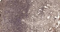 NFATc3 Polyclonal Antibody