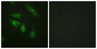 NFATc4 Polyclonal Antibody
