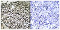 NFATc4 Polyclonal Antibody