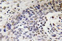 NF-H Polyclonal Antibody