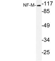 NF-M Polyclonal Antibody