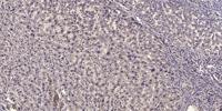 NF-M Polyclonal Antibody