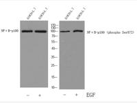 NFκB-p100 Polyclonal Antibody