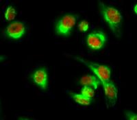 NFκB-p100 Polyclonal Antibody