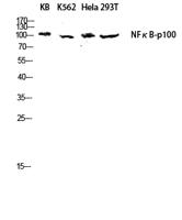 NFκB-p100 Polyclonal Antibody