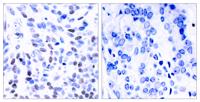 NFκB-p100 Polyclonal Antibody