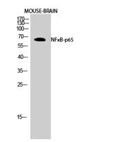 NFκB-p65 Polyclonal Antibody