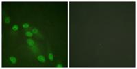 NFκB-p65 Polyclonal Antibody